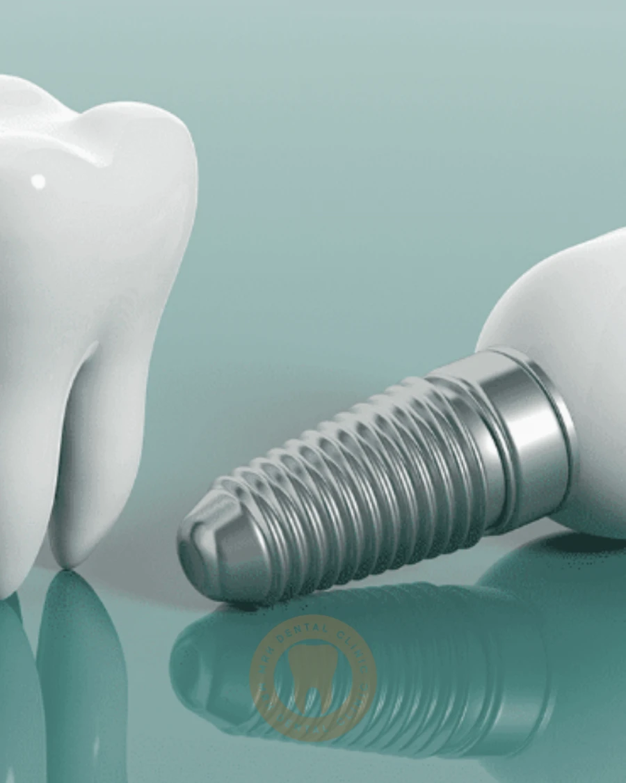 Implant Treatment